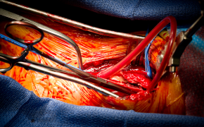 Cirurgia vascular